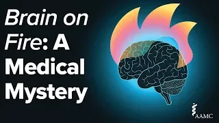 Brain on Fire: A Medical Mystery