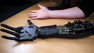 Mind-controlled prosthetic