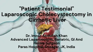 Patient Testimonial | Laparoscopic Cholecystectomy in Liver Cirrhosis | Dr. Imran Abdullah Khan