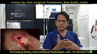 Best treatment for uterine fibroid Hindi