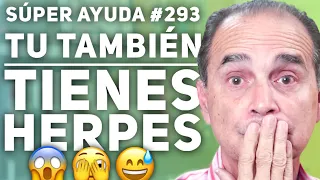 SÚPER AYUDA #293 Tu También Tienes Herpes