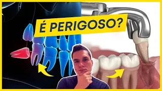 EXTRAIR O SISO É PERIGOSO? (A VERDADE).