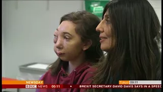 BBC News 21 February 2018