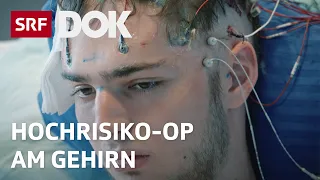 Leben ohne Epilepsie | Hochriskante Hirn-OP soll Anfälle verhindern | Doku | SRF Dok