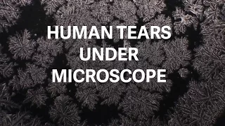 Micrograph photos reveal the unique beauty of tears