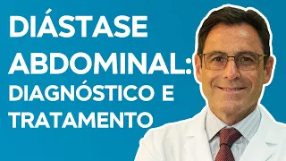 DIÁSTASE ABDOMINAL: Sintomas, Diagnóstico, Causas e Tratamentos