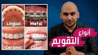 teeth braces, types of braces, Invisalign and metal braces, and different orthodontic prices.