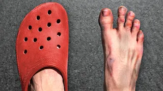 JEG LØB ET ½ MARATHON I CROCS! (mine fødder er ødelagt)