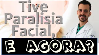 PARALISIA FACIAL? O que fazer? O que não fazer? Cuidados Importantes - Dr. Rogério Souza