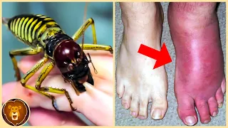 Las 10 Picaduras De Insecto Más Dolorosas Del Mundo