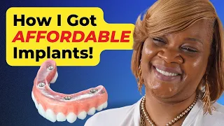 How I Paid for My Dental Implants | A Real Patient's Story