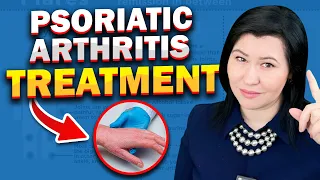 Psoriatic Arthritis  NEW Treatment 2024