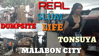 REAL SLUM LIFE||DUMPSITE CATMON AND OTHER SIDE TONSUYA|MALABON CITY, PHILIPPINES