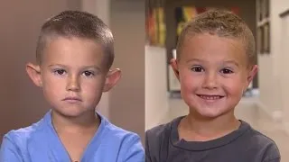 Parents Allow 6-Year-Old Boy with Big Ears to Get Plastic Surgery