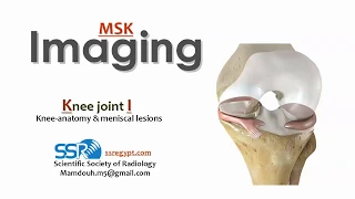 Knee Joint Imaging (part 1) .. Prof.mamdouh Mahfouz (2019 edition)