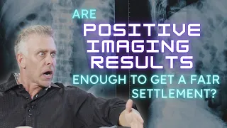 Are Positive Imaging Results Enough to get a Fair Settlement?