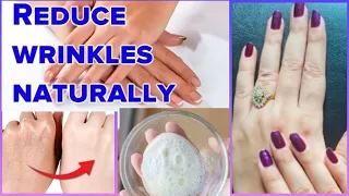 How lighten dark knuckles and brighten hands| Diy Hand & feet tan removel pack| wrinkle free hands|