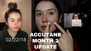 MY ACCUTANE JOURNEY: Month 2 Update