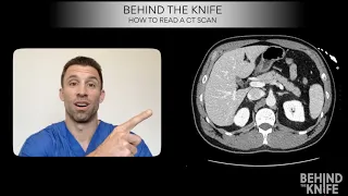 Behind the Knife: How to Read a CT Scan