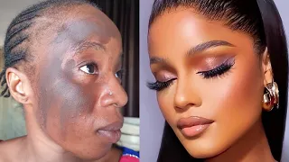 Viral Bomb🔥What She Wanted VS What She Got 😳 Transformation🔥 Cirurgia Plastica 💉💉😳🔥😱😱 makeuptutorial