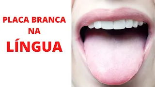 Placa Branca na Língua - Ou Saburra.