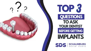 Top 3 Questions to Ask Your Dentist Before Getting Implants