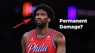 Doctor Reacts to Joel Embiid's Bell's Palsy Diagnosis