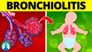 Bronchiolitis (Medical Definition) | Quick Explainer Video