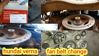 hundai verna belt change  Water pump belt replacement