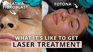 Laser Treatments: Plasma Fibroblast, Fotona 4D Laser, LipLase