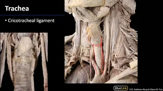 Larynx, Pharynx and CST - Trachea