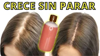 ¡NO LO USES MUCHO! NACE CABELLO HASTA DONDE NO TIENES😱 Y DEJA DE CAER 😍(REMEDIO POTENTE)