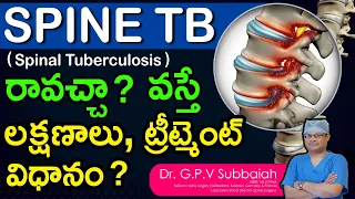 Spinal Tuberculosis (SPINE TB) Causes , Symptoms & treatment I Tuberculosis I TB I Dr GPV Subbaiah