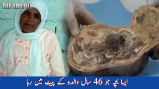 Woman Pregnant For 46 Years | A Moroccan Woman Gave Birth to a Stone Baby | THE TRUTH!!!