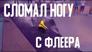 СЛОМАЛ  НОГУ НА  САМОКАТЕ С ФЛЕЕРА!