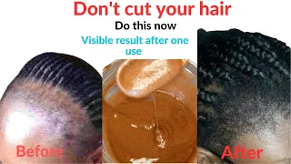 WOW! IT WORKS😱. DON'T CUT YOUR HAIR. How I brought back my lost hair line in 2 weeks