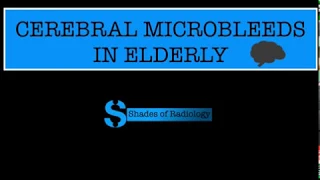 Cerebral Microbleeds in Elderly -TUTE 4