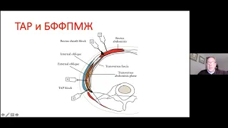 Блокада фасциального футляра прямой мышцы живота