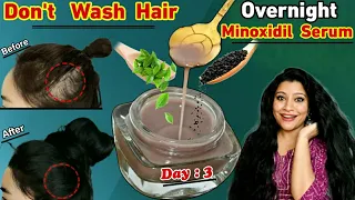 Day 3:Do Not Wash Your Hair Leave Overnight Minoxidil Serum In Hair To Make Hair Regrow Fast