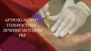 💉Как лечить деформирующий АРТРОЗ-АРТРИТ ГОЛЕНОСТОПА |PRP лечение после травм в PAN CLINIC