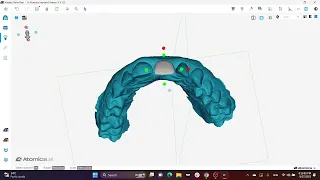 🦷 Atomica's Masterclass Premiere; Guided Surgery Simplified!