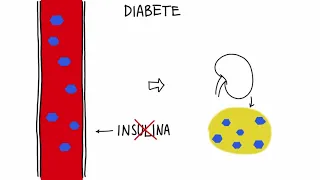 Che cos'è il diabete? (tratto da Polimeri, biochimica e biotecnologie.blu)