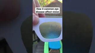 Eye Diseases Vision Simulation