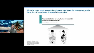 Dr. Farberg - Implementation of Gene Expression Profiling in the Management of Melanoma