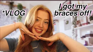 Getting my braces off *vlog of my experience |  Ruby Rose UK