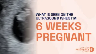 6 Weeks Pregnant: Witnessing the First Heartbeat on ultrasound scan
