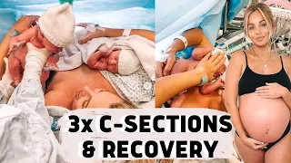 MY C SECTION EXPERIENCE & RECOVERY | Lucy Jessica Carter