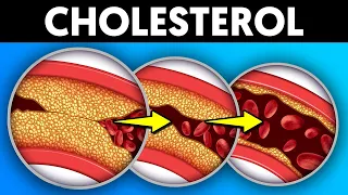 15 Easy Ways to Bring Down Your Cholesterol