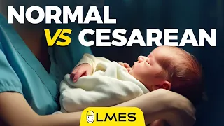 Normal Delivery vs C-section | LMES | Tamil