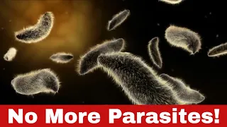 How to Get Rid of Parasites in Humans: 100% Natural Remedies You Need to Know!